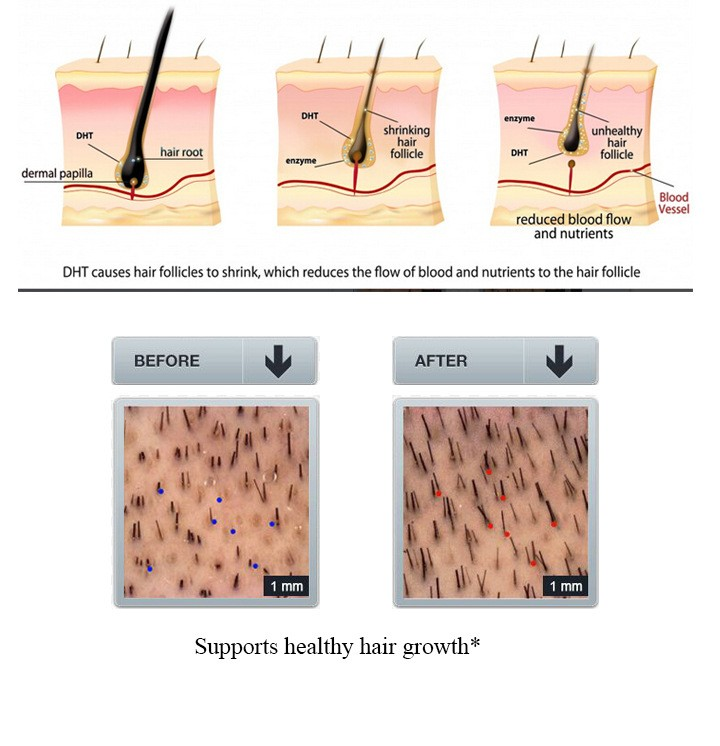 GingerGrow™ Professional Hair Care Kit