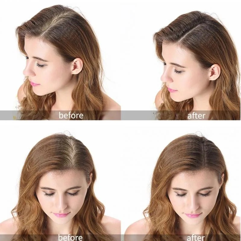 GingerGrow™ Professional Hair Care Kit